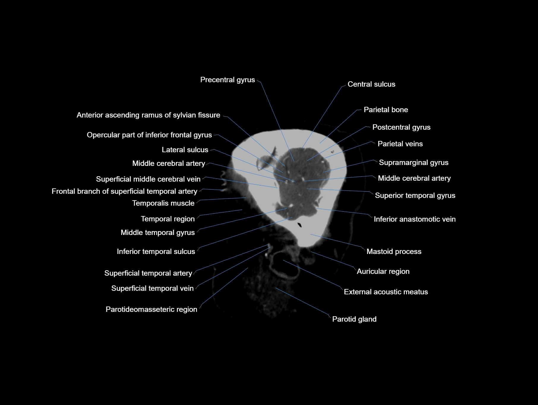 CT scan brain sagittal cross sectional anatomy image-img-00001-00007.webp